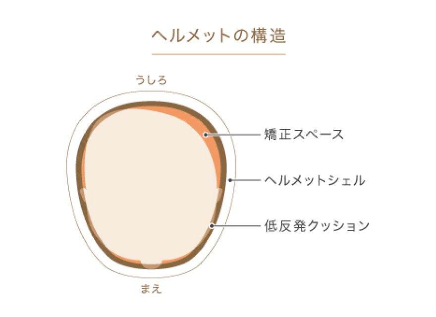 ヘルメットの構造図。低反発クッションと矯正スペースを、ヘルメットシェルで覆っています。